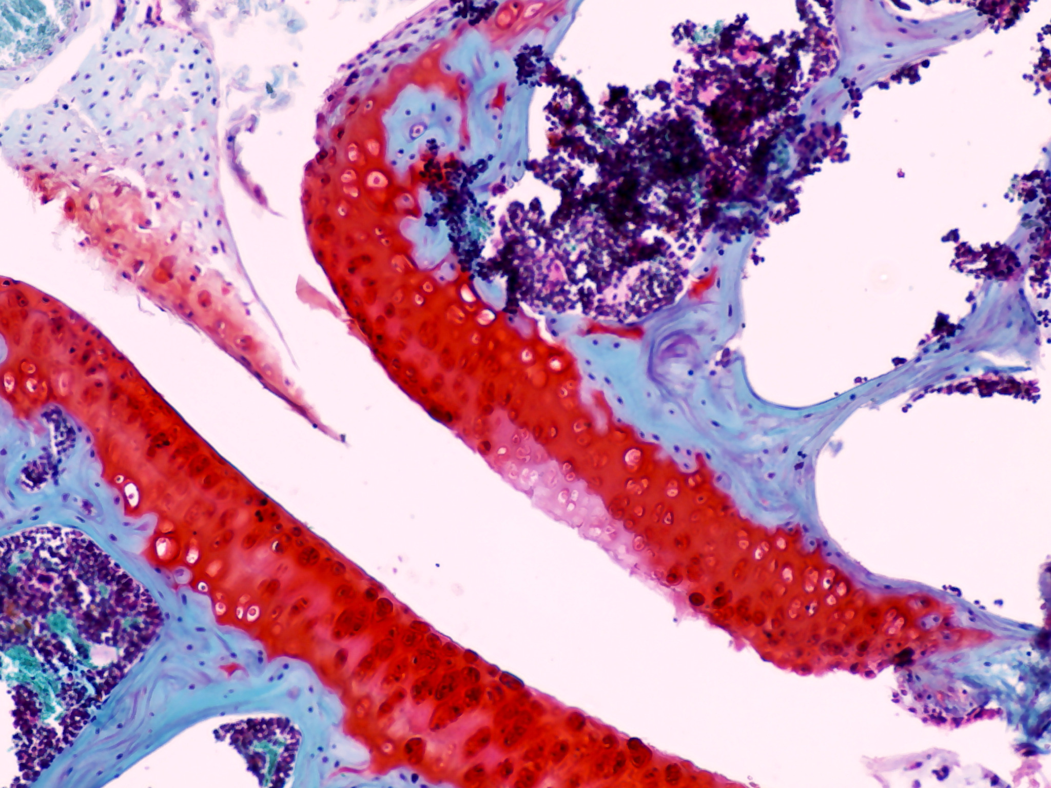 Cell