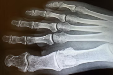 Foot Image